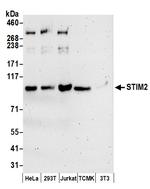 STIM2 Antibody in Western Blot (WB)