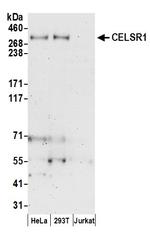 CELSR1 Antibody in Western Blot (WB)