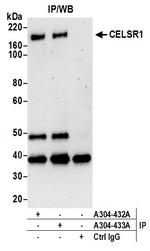 CELSR1 Antibody in Immunoprecipitation (IP)