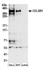 CELSR1 Antibody in Western Blot (WB)