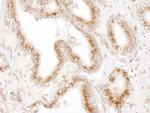 TGOLN2 Antibody in Immunohistochemistry (Paraffin) (IHC (P))