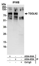 TGOLN2 Antibody in Immunoprecipitation (IP)