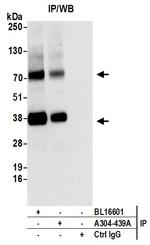 MCT4 Antibody in Immunoprecipitation (IP)