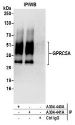 GPRC5A Antibody in Immunoprecipitation (IP)