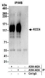 KCC4 Antibody in Immunoprecipitation (IP)