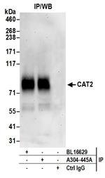 CAT2 Antibody in Immunoprecipitation (IP)