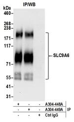 SLC9A6 Antibody in Immunoprecipitation (IP)