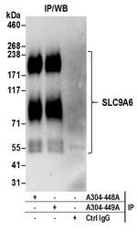 SLC9A6 Antibody in Immunoprecipitation (IP)