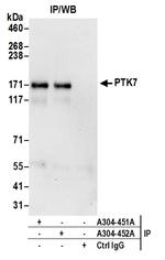 PTK7 Antibody in Immunoprecipitation (IP)