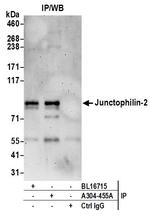 Junctophilin-2 Antibody in Immunoprecipitation (IP)