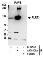 FLRT3 Antibody in Immunoprecipitation (IP)