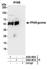 PPAR-gamma Antibody in Immunoprecipitation (IP)