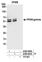 PPAR-gamma Antibody in Immunoprecipitation (IP)