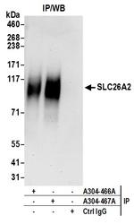 SLC26A2 Antibody in Immunoprecipitation (IP)