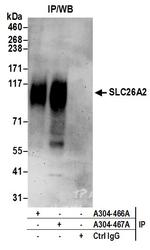 SLC26A2 Antibody in Immunoprecipitation (IP)