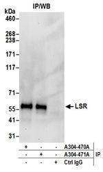 LSR Antibody in Immunoprecipitation (IP)