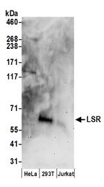 LSR Antibody in Western Blot (WB)