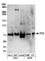 PIT2 Antibody in Western Blot (WB)