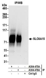 SLC6A15 Antibody in Immunoprecipitation (IP)