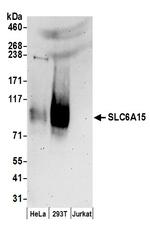 SLC6A15 Antibody in Western Blot (WB)