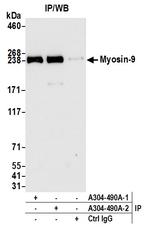 Myosin-9 Antibody in Immunoprecipitation (IP)