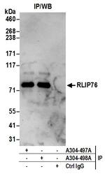 RLIP76 Antibody in Immunoprecipitation (IP)