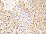 P23 Antibody in Immunohistochemistry (Paraffin) (IHC (P))