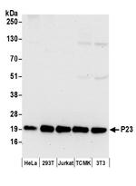 P23 Antibody in Western Blot (WB)