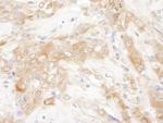 CHMP2B Antibody in Immunohistochemistry (Paraffin) (IHC (P))