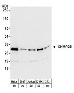 CHMP2B Antibody in Western Blot (WB)