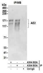 AE2 Antibody in Immunoprecipitation (IP)