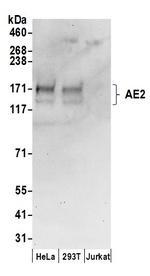 AE2 Antibody in Western Blot (WB)