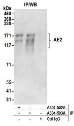 AE2 Antibody in Immunoprecipitation (IP)