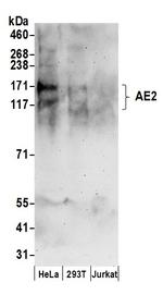 AE2 Antibody in Western Blot (WB)