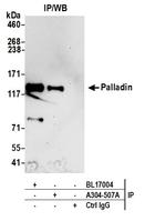 Palladin Antibody in Immunoprecipitation (IP)