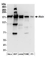 Alsin Antibody in Western Blot (WB)