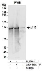 p115 Antibody in Immunoprecipitation (IP)