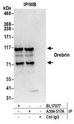 Drebrin Antibody in Immunoprecipitation (IP)