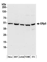 ERp5 Antibody in Western Blot (WB)