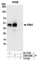 ERp5 Antibody in Immunoprecipitation (IP)