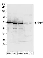 ERp5 Antibody in Western Blot (WB)