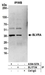 BLVRA Antibody in Immunoprecipitation (IP)