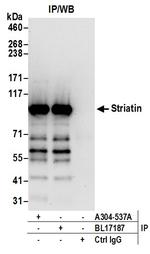 Striatin Antibody in Immunoprecipitation (IP)