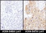 ADE2 Antibody in Immunohistochemistry (Paraffin) (IHC (P))