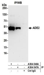 ADE2 Antibody in Immunoprecipitation (IP)