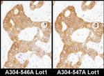 ADE2 Antibody in Immunohistochemistry (Paraffin) (IHC (P))