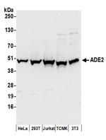 ADE2 Antibody in Western Blot (WB)