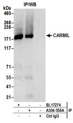 CARMIL Antibody in Immunoprecipitation (IP)