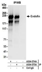 Endofin Antibody in Immunoprecipitation (IP)