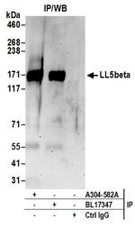 LL5beta Antibody in Immunoprecipitation (IP)